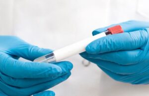 Обнаружен способ выявить опасную болезнь до появления симптомов