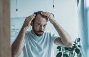 Выпадение волос у мужчин: причины, признаки, как остановить, лечение