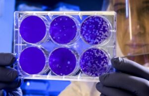 Ученые предупредили о превращении COVID-19 после новой мутации в «гробовирус»