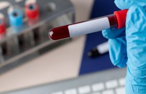 Скандал со смертельно зараженной американской кровью привел к крупнейшей медицинской катастрофе