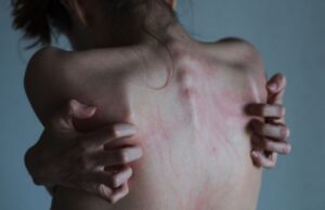 Аутоагрессия: что это в психологии, причины, симптомы, виды, как бороться