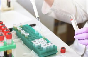 Появился новый способ предупреждения распространенного онкологического заболевания