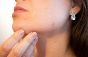 Диетолог Гупта раскрыл, что нужно делать в сезон дождей для здоровой кожи